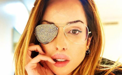 Ispovijest manekenke kojoj je bivši prosuo kiselinu u lice