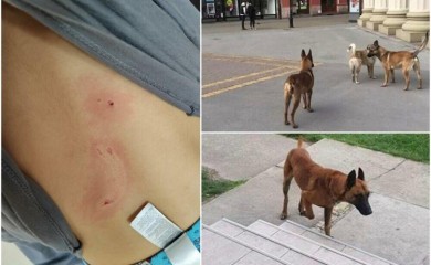 Psi koji su izgrizli djecu oduzeti vlasniku