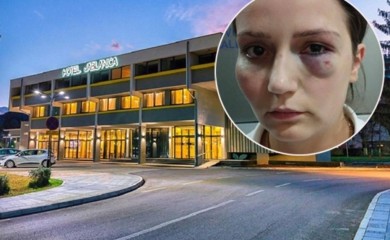 Pretučena radnica uoči protesta: Očekujem veliki broj ljudi, teško se oporavljam