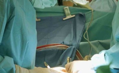 Prva transplantacija bubrega na dečijoj klinici u Beogradu