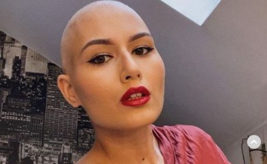 "Kad je teško čovjek vidi koliko toga može izdržati" Ohrabrujuće riječi Banjalučanke Katarine (21) o borbi sa opakom bolešću