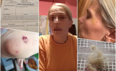 Maloljetnica pretukla medicinsku sestru u Nišu