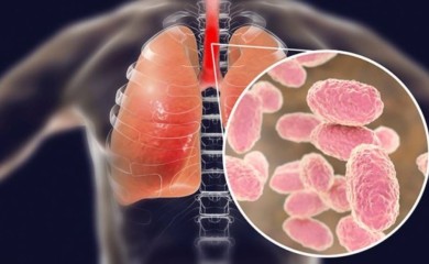 Posljedica izbjegavanja vakcina: Potvrđeno 16 slučajeva velikog kašlja u Srpskoj