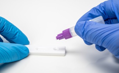 SRBIJA: Registrovano 1.446 novozaraženih, petoro preminulih