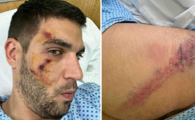 Policajci u Valjevu pretukli i bivšeg kolegu, advokat objavio fotografije