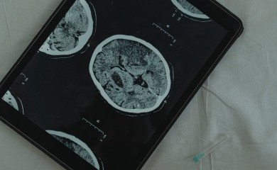 Maskova kompanija će ove godine izvršiti prvu implantaciju moždanog čipa
