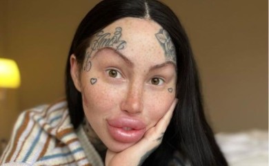 Mogla umrijeti: Potresne fotografije zavisnice od plastične hirurgije (FOTO/VIDEO)