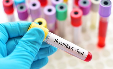 HERCEG NOVI:  Proglašena epidemija žutice