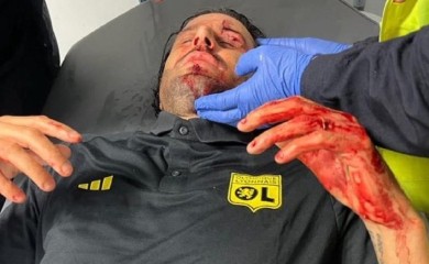 Detalji napada u Marseju: Majmunski urlici i nacistički pozdravi (FOTO/VIDEO)