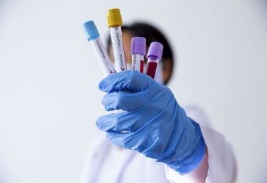 KORONA: Virus potvrđen kod 111 lica od ukupno 311 testiranih