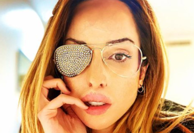 Ispovijest manekenke kojoj je bivši prosuo kiselinu u lice