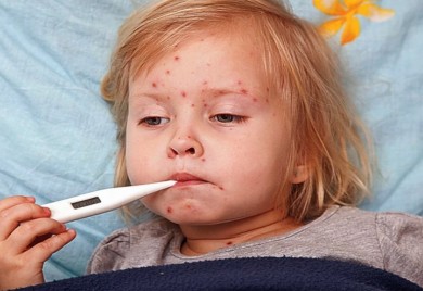 MMR vakcinom vakcinisano 60 odsto djece predškolskog uzrasta: Epidemija malih boginja na pragu