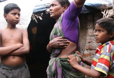 Indijka optužila muža za krađu i prodaju bubrega