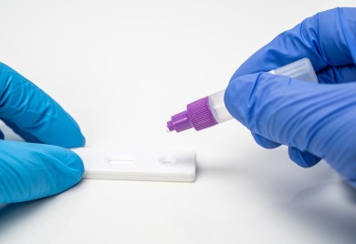 SRBIJA: Registrovano 1.446 novozaraženih, petoro preminulih