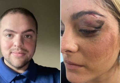 “Bilo je zabavno”: Oglasio se momak koji je razbio glavu albanskoj pjevačici FOTO