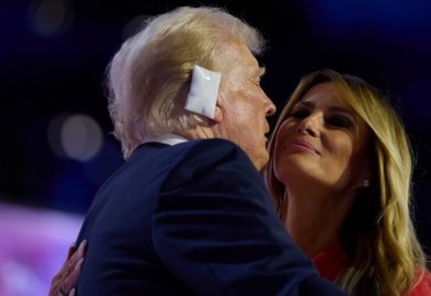 METAK ZAMALO ZAVRŠIO U GLAVI Izvještaj o zdravstvenom stanju Trampa otkriva nove detalje o povredi