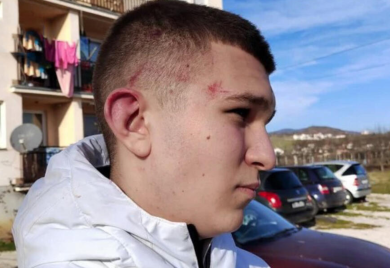 Napadnuti dječak na KiM: Imam jake bolove, plašim se za svoju bezbjednost (VIDEO)