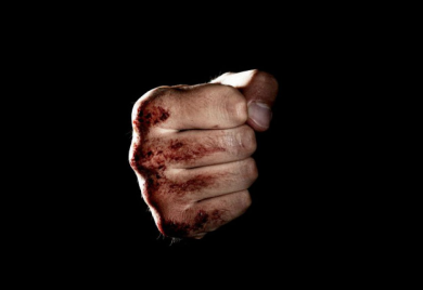 Epilog brutalne tuče u Banjaluci: Uhapšeni napadači, žrtva oficir u Zalužanima