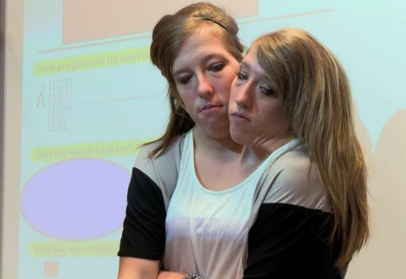 Kako je moguće da dvije žene koje dijele jedno tijelo postanu majke? Najpoznatije SIJAMSKE BLIZNAKINJE pokazale svoju bebu