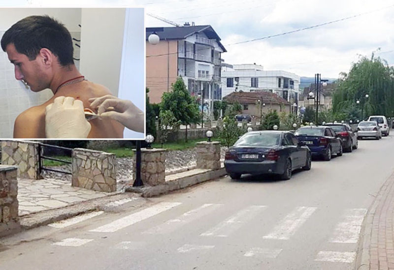 Novi incident na KiM: Srbin izboden nožem u selu kod Vitine