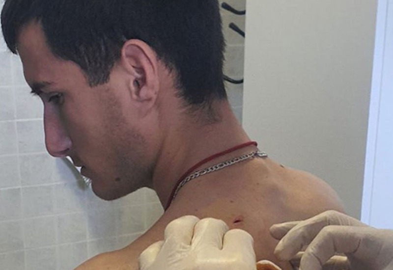 ĐUZIĆ: Napadnut sam iz čista mira, došli su s leđa