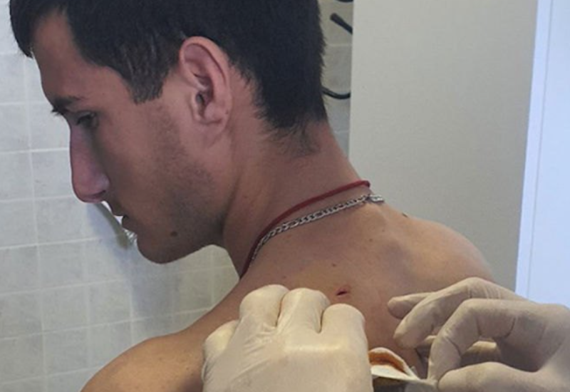 Đuzić stabilno, dvojica napadača na slobodi