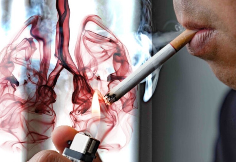 Broj pušača raste: Porodični ljekari Srpske u borbi protiv pušenja