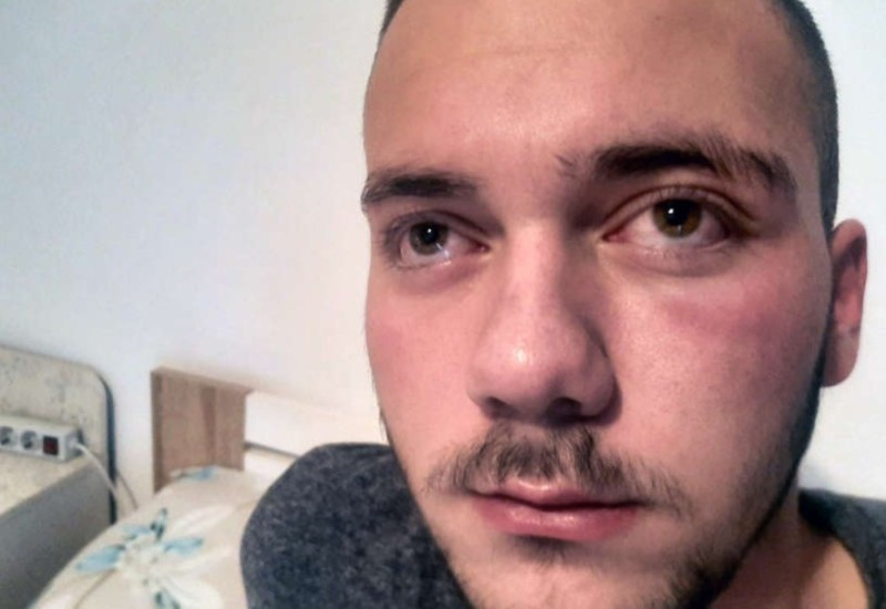 Grupa Albanaca pretukla mladića kada se vraćao sa Božićne liturgije