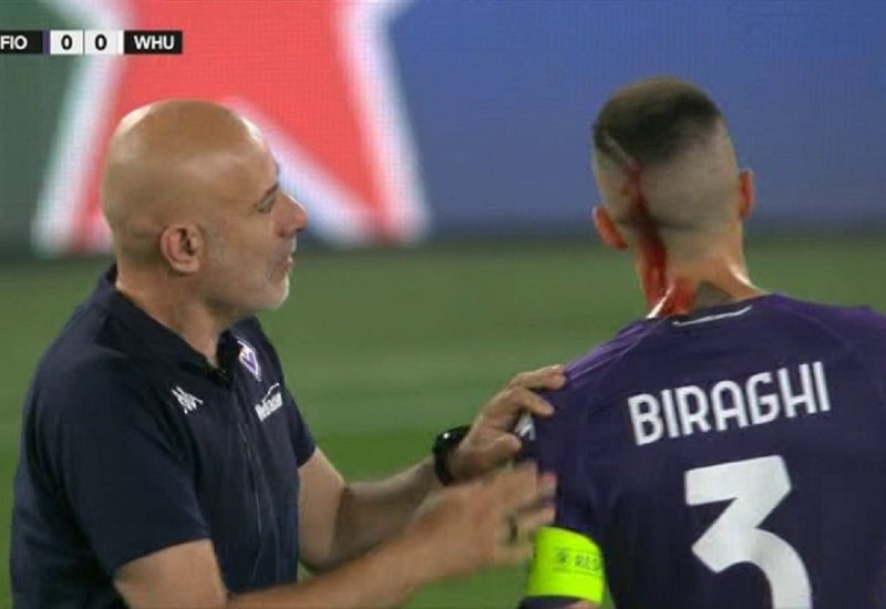 Kapiten Fiorentine krvave glave napustio teren (VIDEO)