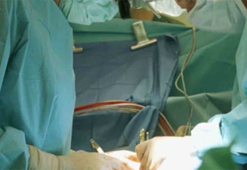 Prva transplantacija bubrega na dečijoj klinici u Beogradu