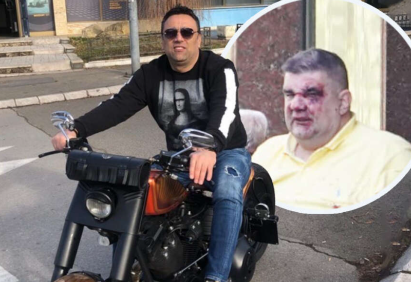 Isplivali detalji o napadu na Sašu Mirkovića, Boško Janković BIO NA LICU MJESTU