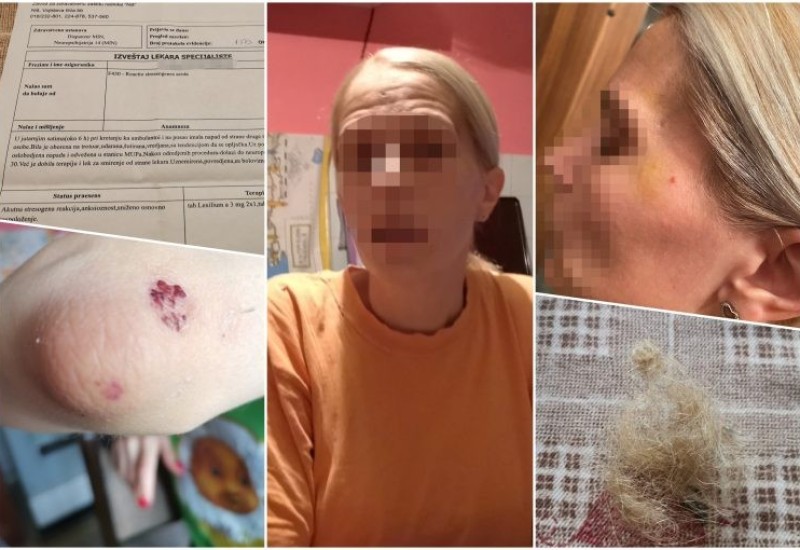 Maloljetnica pretukla medicinsku sestru u Nišu