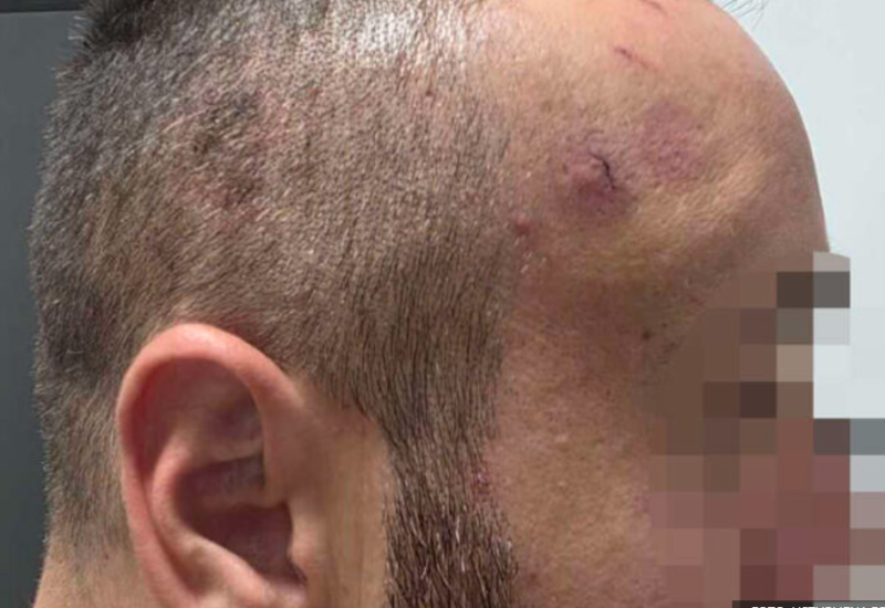 Prva zvanična izjava žrtve policijske brutalnosti u Banjaluci: Prijetili su da će me ubiti i stajali mi nogom na vrat
