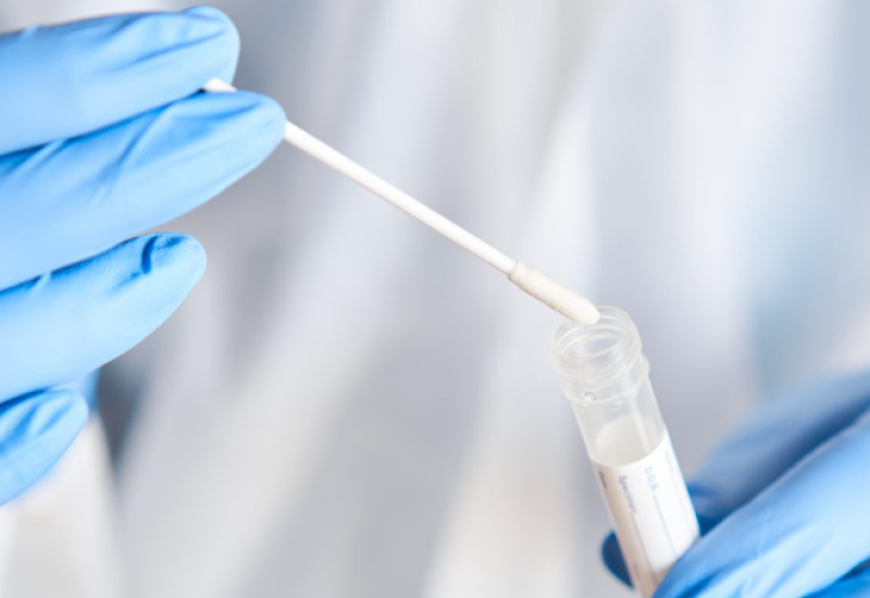 FBiH: Nova 22 slučaja zaraženih virusom korona