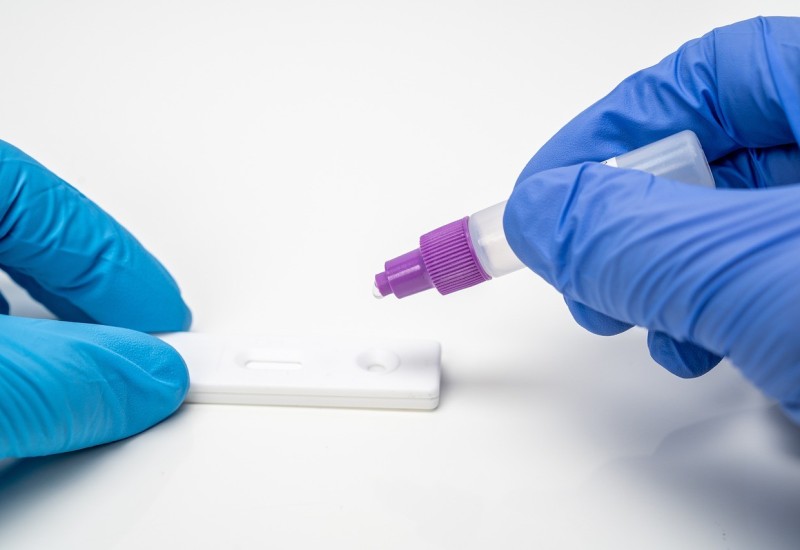 SRBIJA: Registrovano 1.446 novozaraženih, petoro preminulih