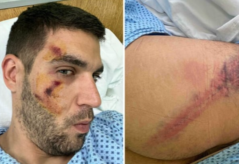 Policajci u Valjevu pretukli i bivšeg kolegu, advokat objavio fotografije