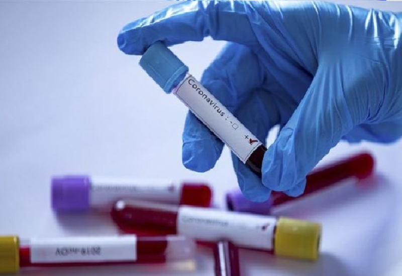 HRVATSKA: Zabilježeno novih 570 slučajeva korone