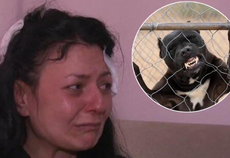 Ispovjest žene koju su napali pitbulovi: Prekrila sam lice, ali su mi kidali tjeme glave