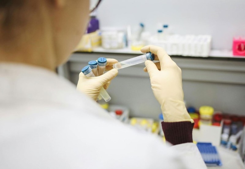 Zabrinjavajući podaci: Raste broj oboljelih od hepatitisa B u Srpskoj