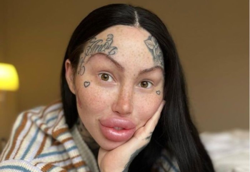 Mogla umrijeti: Potresne fotografije zavisnice od plastične hirurgije (FOTO/VIDEO)