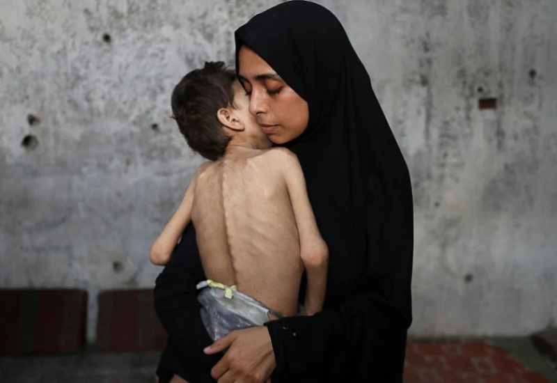 "Izazvana ljudskim djelovanjem" U Gazi proglašena akutna glad, katastrofalni uslovi će nastaviti da se šire