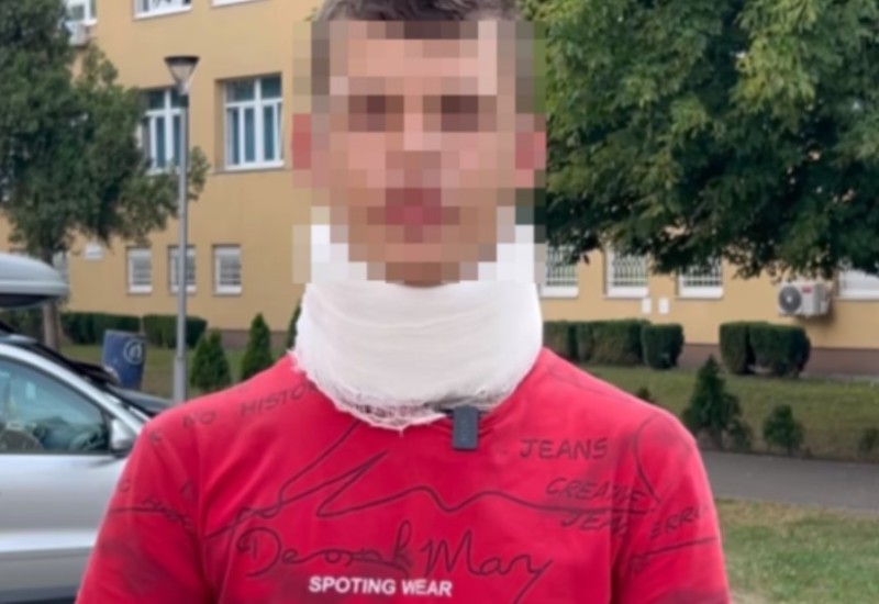 Maloljetnik tvrdi da je pretučen u policijskoj stanici u Osmacima VIDEO