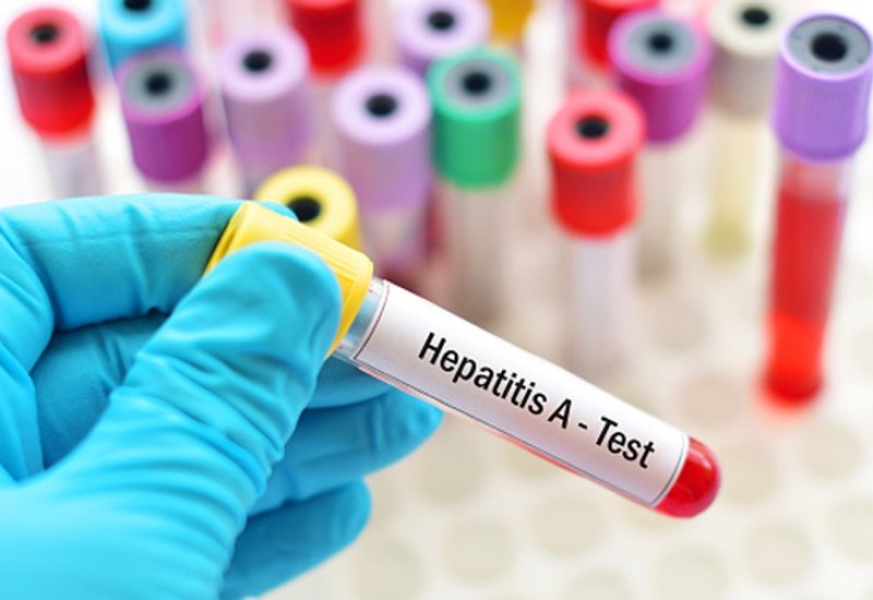 HERCEG NOVI:  Proglašena epidemija žutice