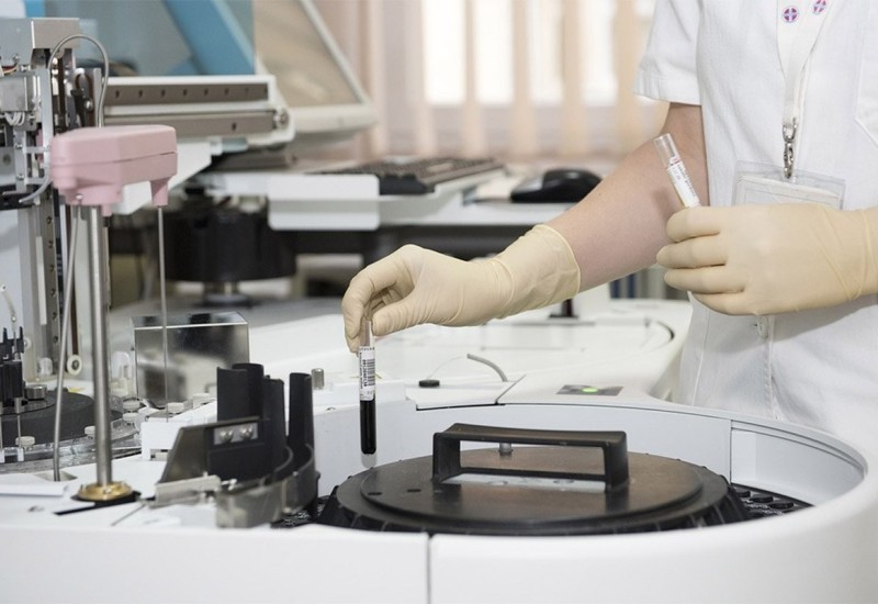 Pacijent negativan na testu, Marburška bolest nije stigla u Evropu