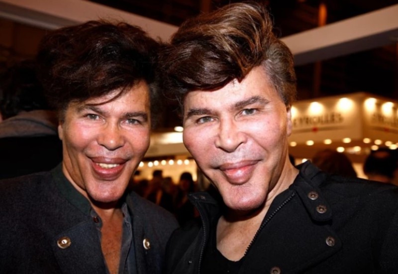 Ekscentrični blizanci umrli u razmaku od šest dana: Odrasli u aristokratskoj porodici, a prije plastičnih operacija bili sinonim muške ljepote