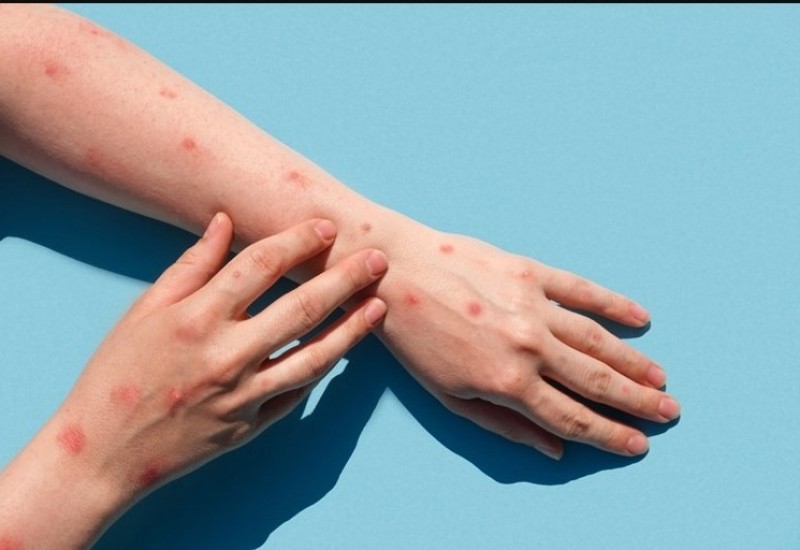 Majmunske boginje će dobiti novo ime