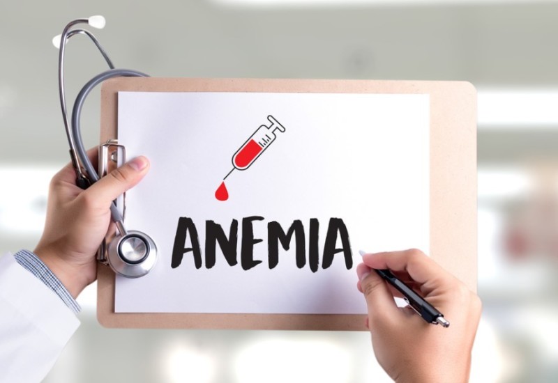 Ovo su simptomi anemije: Ne ignorišite, može dovesti do ozbiljnih problema