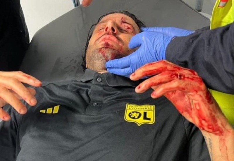 Detalji napada u Marseju: Majmunski urlici i nacistički pozdravi (FOTO/VIDEO)